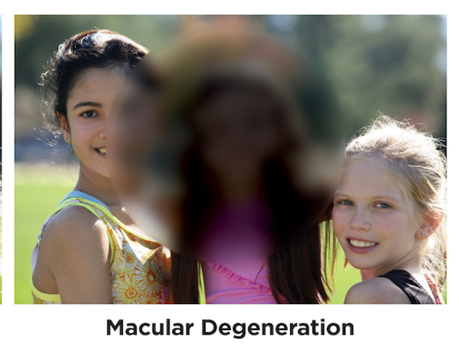 Macular Degeneration through the eyes of someone who has the disease